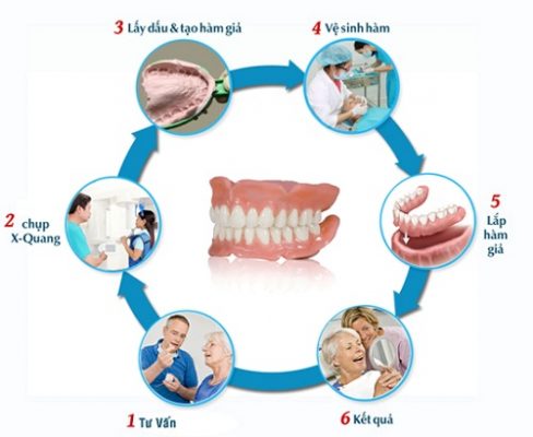 răng giả tháo lắp