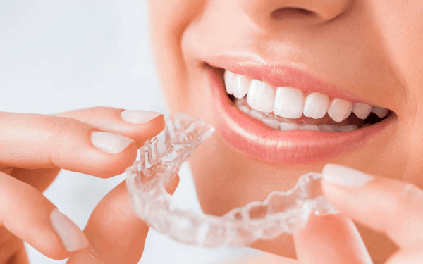 nha khoa tuan hung dia chi nieng rang invisalign o thai binh uy tin hang dau hien nay1