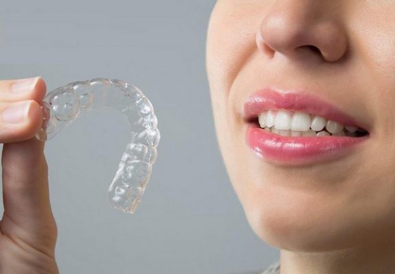 nha khoa tuan hung dia chi nieng rang invisalign o thai binh uy tin hang dau hien nay3