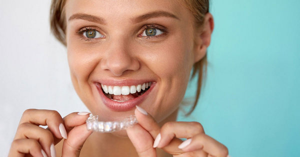 thoi gian nieng rang invisalign la bao lau 3